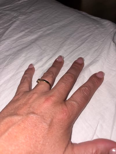 A close-up, overhead shot shows a person's left hand lying on a white, wrinkled surface, possibly a bedsheet. The hand has several fingers visible, with French manicured nails that show some wear. A thin, gold band with a small, clear stone is worn on the ring finger. The skin on the hand appears to have some minor imperfections, and a vein is visible on the back of the hand. The lighting suggests the image was taken indoors, possibly at night or in a dimly lit room. The context of Málaga, Spain, is not discernible from the visual information provided in the image.
