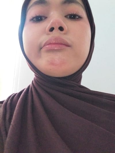 The image is a close-up, low-angle, selfie-style shot of a young woman wearing a dark brown hijab. Her face is the primary subject, with her eyes, nose, and mouth visible. The background is a plain, lightly colored wall, suggesting an indoor environment. There are some visible imperfections on her chin area, appearing as redness or minor blemishes. The lighting is bright, coming from the left side of the frame, creating some highlights on her skin and lips. The focus is sharp on her face, while the fabric of the hijab is slightly out of focus. The scene does not contain any information that would allow for determining its specific location in Watampone, Indonesia.