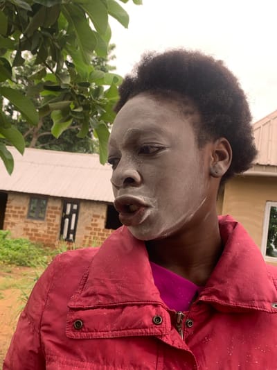 A medium shot, taken outside in Agban, Nigeria, depicts a person with dark skin covered in a pale, possibly powdery, substance on their face and neck. They are wearing a red jacket over a purple garment. The individual is positioned near a lush green tree with large leaves, and behind them is a building with light-colored walls and dark window frames. The building appears to be constructed of brick in some areas. The scene is overcast.