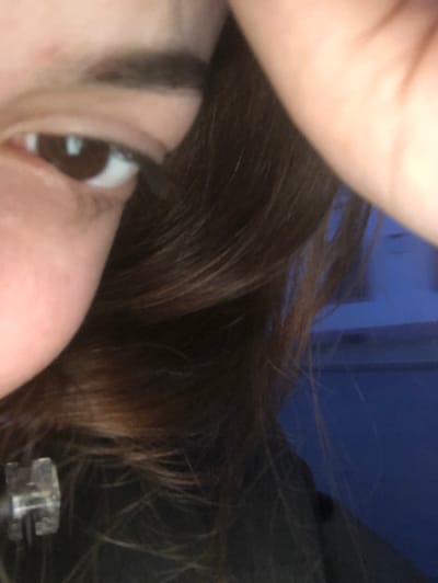 A close-up shot features a person's face, focusing on their eye and surrounding skin. The eye has a brown iris. Brown hair surrounds the face. A possible hand obscures the upper portion of the image. A small, clear object with metallic details appears near the bottom right corner of the frame. In the background, a dark blue or black surface is visible. The lighting is somewhat dim, creating soft shadows on the skin.