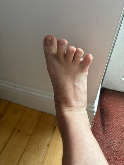 The image shows a close-up view of a person's foot, which appears to be resting on a light-colored wall with a white baseboard. The floor in the foreground is made of light-colored wooden planks, while to the right, a textured, reddish carpet is visible. The lighting suggests an indoor environment. The foot has visible toenails, some of which appear slightly damaged or discolored. The skin of the foot and lower leg is fair and shows fine hairs. The image does not provide any information about the city of Cork, Ireland, or any other specific location.