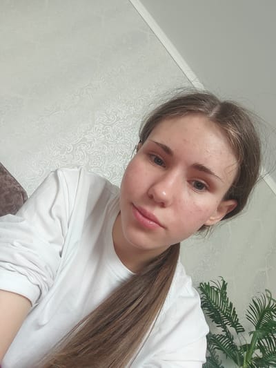 A young woman with light brown hair tied in a ponytail, wearing a white long-sleeved shirt, poses for a selfie in an indoor setting. The background features patterned wallpaper and a glimpse of a brown couch on the left and a potted plant with green fronds on the right. The woman's face is looking towards the camera, and her skin shows some redness and minor blemishes. The lighting suggests an indoor environment, possibly a home, with soft illumination. The image does not provide specific details that would allow for the identification of its location within Svietlahorsk, Belarus.