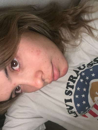 A close-up, angled selfie captures a person with light brown hair lying down. The person's face is oriented towards the camera, displaying brown eyes, freckles, and a slight redness around the nose area. The person is wearing a white t-shirt with a graphic design, including the word "STRAUSS" and a pattern of stars and stripes. The background appears to be a neutral-colored surface, possibly a pillow or bedding. The location and environment in Sumalao, Argentina, are not discernible.