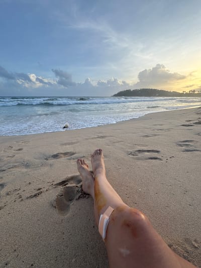 The image captures a serene beach scene in Thalaramba, Sri Lanka, viewed from a low perspective. In the foreground, a person's bare legs and feet rest on the light brown sand, extending from the bottom right towards the center. The right knee shows a noticeable bruise or discoloration, and a beige band-aid is applied to the shin just below the knee. Another patch of discoloration is visible on the lower right leg, near the foot. A silver-colored ring adorns one of the toes on the left foot. Several footprints are impressed in the sand.
To the left, gentle ocean waves roll onto the shore, leaving white foam along the waterline. A small, light-colored object, possibly a shell or rock, is visible near the water's edge. The coastline stretches into the distance, revealing a lush, dark green forested area or hill under a warm, glowing sky.
The time of day appears to be late afternoon or early evening, indicated by the golden light illuminating the horizon and the upper parts of the clouds. The sky transitions from a bright yellow and orange hue near the sun-kissed horizon to a softer blue and grey with scattered clouds further overhead. The overall atmosphere is tranquil, despite the visible injury on the leg. No discernible text is visible in the image.