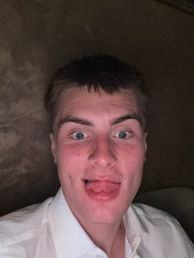A young adult male, with short dark-brown hair, is centered in a close-up, frontal shot. He has light blue eyes that are wide open with dilated pupils, and dark eyebrows. His face, particularly the nose, cheeks, and forehead, shows a reddish flush. His mouth is open, with his tongue extended slightly forward. He is wearing a white collared shirt, visible at the neck and shoulders. The background is dark and indistinct, appearing as a textured, brownish-grey surface. The scene is located in the city of Slivnitsa, Bulgaria.