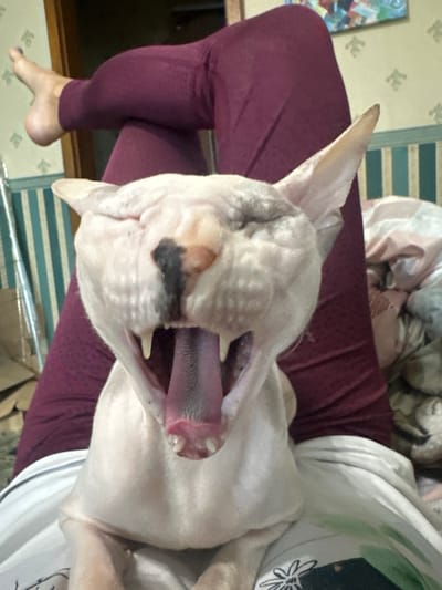 The image captures a close-up of a hairless cat yawning, its mouth wide open revealing its tongue and teeth. The cat is light-skinned with some darker markings on its face. It appears to be resting on a person's lap, evidenced by the glimpse of legs in burgundy leggings and a white blanket. The background shows a wall with vertical striped wallpaper and a portion of a bed with patterned bedding. There are no discernible landmarks or elements that would indicate the location as Togliatti, Russia.