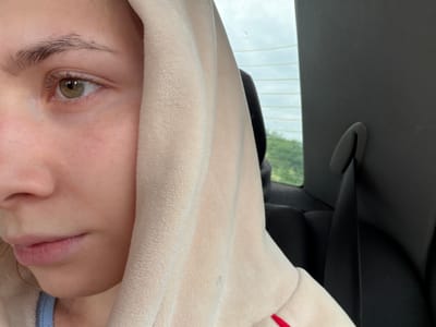 A close-up, medium shot captures the left side of a young person's face, from the eye to the chin. They are wearing a light-colored, plush hooded garment that partially obscures their face and head. The person's eye is a striking green-brown, with visible eyelashes and a faint eyebrow. Their skin appears fair with a scattering of freckles. The background suggests they are in a vehicle, with a dark car seat visible to the right and a window behind them showing a blurry landscape of greenery under an overcast sky. There is no indication of the location being Oreshniki, Russia.