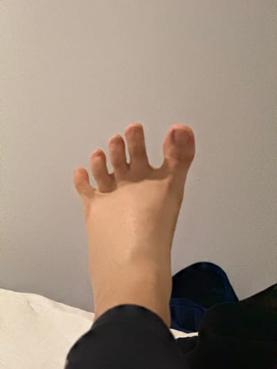 The image shows a close-up view of a human foot, with toes spread, against a neutral, plain background. The foot is positioned centrally in the frame, with the toes extending upwards and slightly to the left. The skin tone is light, and the toes appear to be healthy. The background is a plain, textured wall in a light beige or grey color. There are no other discernible objects or features in the immediate vicinity of the foot. The scene is indoors, possibly in a bedroom, given the presence of what appears to be a white sheet or duvet at the bottom left of the frame and dark fabric at the bottom right. There is no information available about the location in Yundola, Bulgaria.