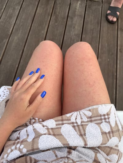 An overhead shot shows a person's legs and hand resting on a wooden deck. The person's skin appears to have mild redness and is covered by a towel around the lower legs. The hand is positioned on the left thigh, displaying bright blue painted fingernails. A black sandal is visible in the upper right corner of the image. The lighting suggests an outdoor setting.