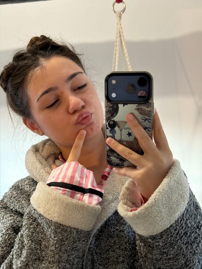 An indoor, close-up mirror selfie depicts a young female individual from the upper torso, captured against a plain, light-colored background. The individual has dark brown hair styled in an updo and exhibits minor blemishes on her chin and forehead. Her lips are pursed, and her right index finger is positioned against her chin. She is dressed in a grey, textured, long-sleeved garment with light-colored, fluffy cuffs and collar. A pink and white striped garment is visible on her left arm beneath the outer layer, and a plain pink garment on her right side. She holds a smartphone in her right hand, oriented towards herself. The phone features a dark-colored camera module with two lenses and is encased in a decorative cover displaying graphics such as a disco ball, a cocktail glass, an '8' ball, leopard print, and lips. Suspended from the ceiling directly above her head is a macrame-style rope hanger, secured by a red metal ring. The specific location within Bouxwiller, France, cannot be determined from the visual information provided in the image.