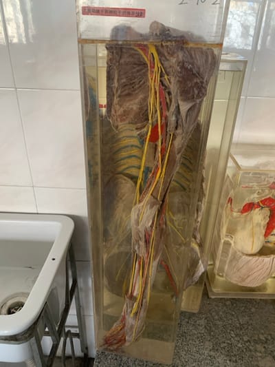 Anatomical specimen of a human arm encased in clear acrylic. Muscles, nerves (yellow), and arteries (red) are dissected and preserved. The specimen is displayed in a laboratory setting. White tiles and a sink with a metal frame are visible in the background. A label with Chinese text is attached to the side of the acrylic case. Another anatomical specimen is displayed above it.