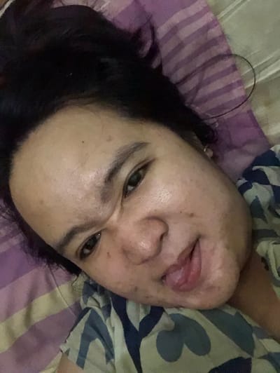 A person lies on a bed with a purple and white striped pillow and a patterned comforter. Their face is turned towards the camera, with their tongue sticking out playfully. They have dark hair, defined eyebrows, and brown eyes. Skin blemishes are visible. The overall impression is casual and relaxed.