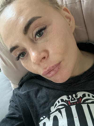 A fair-skinned woman with blonde hair is lying down, likely on a bed, based on the visible pillow. She is wearing a dark gray t-shirt with a white and red graphic print. The woman has green eyes, dark eyebrows, and false eyelashes. A scar is visible above her upper lip. The location in the city of Высокий, Russia, cannot be verified.