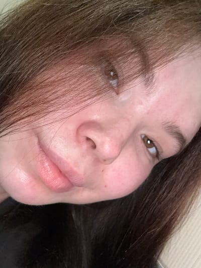 The image is a close-up, low-angle shot of a young woman's face. She has brown hair that falls across her forehead and side of her face, obscuring part of her right eye. Her left eye is visible, with a brown iris and visible eyelashes. Her skin appears fair with some redness and what might be light freckling. Her lips are slightly parted and appear to be a natural pink color with a glossy sheen. The lighting suggests an indoor setting, likely natural light from a window or a soft artificial light source. There are no identifiable landmarks or background elements that would indicate a specific location within Surgut, Russia, or any other city. The image focuses solely on the woman's facial features.