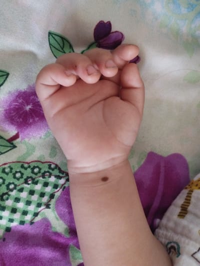 The image shows a close-up of a baby's left arm and clenched fist resting on a patterned fabric. The fabric has floral and geometric designs in purple, green, and white. The baby's skin is fair. There is a small, dark mole on the underside of the baby's wrist. The baby's fingers are curled into a fist. The lighting suggests it could be daytime, and the setting appears to be indoors, likely a bed or crib, given the soft fabric. There is no visible text in the image. The image conveys a sense of peacefulness and innocence.