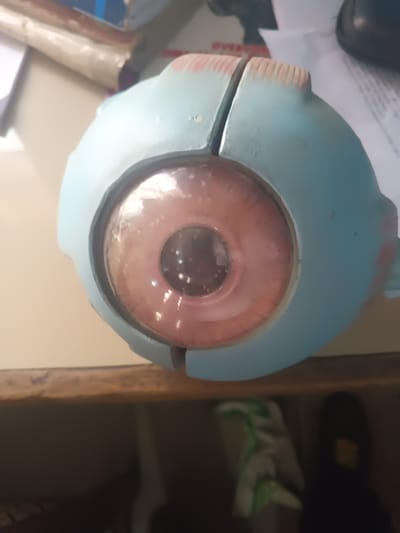 A light blue anatomical model of a human eye occupies the central foreground, resting on a light brown surface. The model features a transparent cornea covering a pinkish-brown iris with a dark central pupil. Numerous small, reflective white specks are visible on or within the cornea. The light blue exterior displays a prominent vertical seam, indicating its two-part construction. Reddish-brown textured elements are present on the superior posterior aspect of the model, consistent with representations of ocular muscles or surrounding tissue. The model exhibits minor surface wear and discoloration. The background is out-of-focus, with white papers and a dark object visible in the upper right. Below the immediate surface, a darker, indistinct area contains a blurred white and green object alongside a dark, amorphous silhouette. The scene depicts an indoor environment, likely a classroom, laboratory, or medical facility, situated in Warri South, Nigeria.