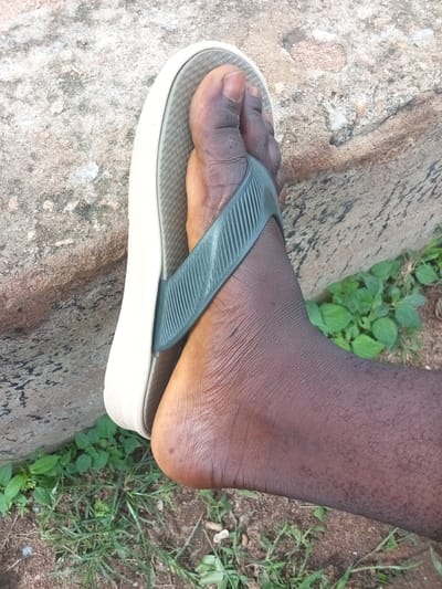 In Zinna, Nigeria, a person's left foot, clad in a dark grey flip-flop with a beige sole, rests on a rough, textured, light-colored surface, likely a concrete slab or large stone. The foot is dark-skinned, with visible toes and the arch of the foot. The flip-flop strap is positioned between the big toe and the second toe. The background consists of sparse green vegetation and soil.