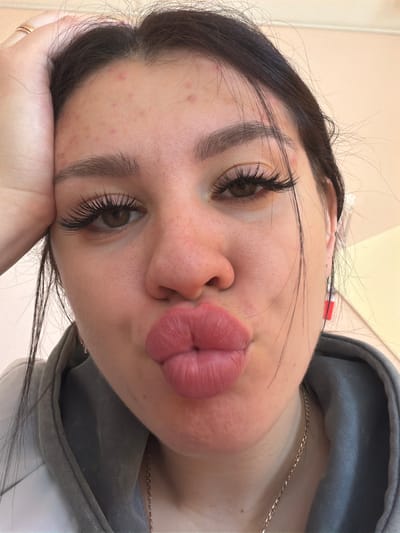 The image is a close-up, forward-facing selfie of a young woman's face. She is leaning her forehead against her left hand, which is resting on her head. Her lips are pursed in a kissing gesture, and her eyes are open. She has long, dark eyelashes, dark eyebrows, and dark hair. Her skin has some small red blemishes, particularly on her forehead. She is wearing a light gray hooded sweatshirt and a thin silver necklace. A red and white earring is visible on her right ear. The background is a plain, light-colored wall. The location is identified as Гаревая, Russia.