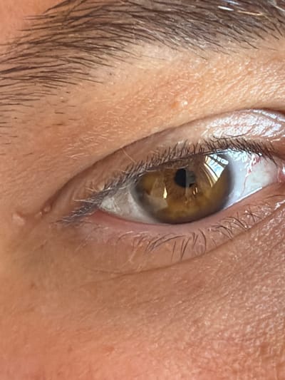 The image is a close-up, angled shot of a human eye. The iris is a warm, medium brown color with lighter flecks and darker radial lines. The pupil is a dark, circular void in the center. The sclera is visible around the iris, with some fine red blood vessels. The eyelids are lined with dark eyelashes, and the skin surrounding the eye shows subtle texture and pores. There is a slight reflection visible in the eye, suggesting an indoor or well-lit environment. The overall lighting creates a warm tone. The image does not contain any elements that would allow for location identification within Kassandra Municipal Unit, Greece.