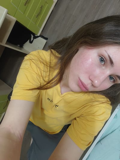 A young woman with long brown hair and blue eyes is taking a selfie. She is wearing a yellow t-shirt and dark grey shorts. Her skin is flushed, and she has some blemishes on her face. She is leaning on her arm, and her head is tilted. The background appears to be a bedroom, with a wardrobe and a shelf visible. The overall impression is of a casual, everyday moment.