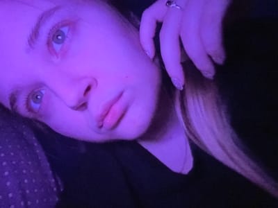 The image displays a close-up, angled view of a young female subject within an indoor setting illuminated by a prominent purple light source. The subject has light-colored eyes, visible pupils, and light eyebrows. Her lips are slightly parted, and a small red mark is visible on her right cheek. Light-colored hair, possibly blonde, extends over her right shoulder. She is wearing a dark garment. Her right hand is raised to the side of her face near her ear, with fingers slightly curled. A silver-toned ring with a dark stone is present on her right ring finger, and her fingernails display a glittery, textured polish. A dark fabric with white polka dots is partially visible on the far left. The background is largely indistinct, appearing dark due to low light. The subject's posture suggests she is reclining or lying down, looking towards the camera. The specific location within Pushchino, Russia, cannot be identified from the visual characteristics present in the image.