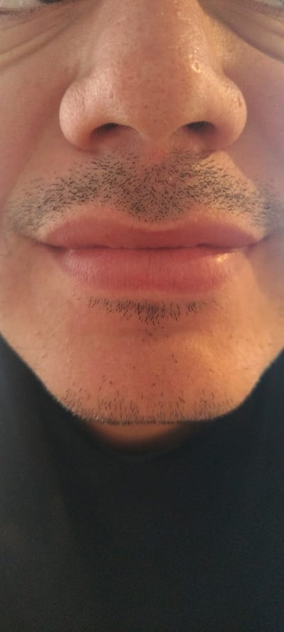 This close-up, rotated portrait captures a person's lower face, focusing on the nose, mouth, and chin area, viewed from a low angle. The subject has fair to light-brown skin with visible pores and texture. Short, dark stubble is present on the upper lip, chin, and along the jawline, indicating recent beard growth. The lips are closed, appearing full and naturally reddish-pink, with a slight highlight on the upper lip suggesting moisture. The nose is prominent and well-defined. The background is a plain, dark, and out-of-focus area, suggesting an indoor setting. There is no discernible activity taking place, and the expression is neutral. No emotions or specific time of day can be determined. No text is visible. The image provides no visual cues to confirm the specified location of Cuernavaca, Mexico.