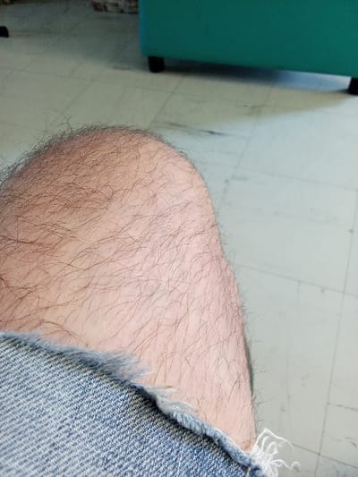 The scene depicts an indoor environment in Clermont-Ferrand, France. The primary subject is the exposed upper right thigh and knee of an individual, viewed from a slightly elevated perspective. The skin is light-toned and covered with numerous dark, fine hairs. A portion of a blue denim garment, likely shorts or torn jeans, is visible in the lower left, featuring a frayed, unfinished edge with white threads. The floor is light-colored, possibly linoleum or large tiles, showing faint grid lines and minor surface marks. In the upper right background, a segment of a teal or turquoise upholstered furniture piece, supported by dark, possibly black, legs, is partially visible. No specific actions or interactions are depicted beyond the subject's presence in this setting.