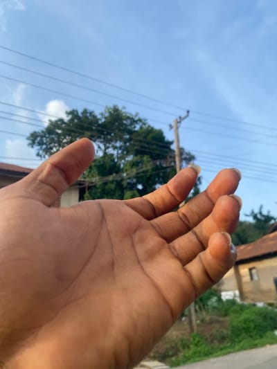 The image depicts a human's open right hand in the foreground, palm facing upwards, fingers slightly curled, against a backdrop of a clear blue sky and an urban environment in Igarra, Nigeria. The hand exhibits a dark skin tone, with visible palm lines and natural, somewhat lengthy fingernails. In the mid-ground, a large, dense green tree dominates the left side, partially obscured by the hand. To the right, a wooden utility pole with multiple overhead power lines extends vertically towards the top of the frame. Portions of residential buildings are visible on both sides; a structure with a dark roofline appears on the far left, and a building featuring a reddish-brown tiled roof and a light-colored wall with a dark rectangular opening is present on the far right. The lower portion of the background reveals green shrubbery and a section of what appears to be a paved road or pathway. The scene is illuminated by natural daylight, indicating daytime.