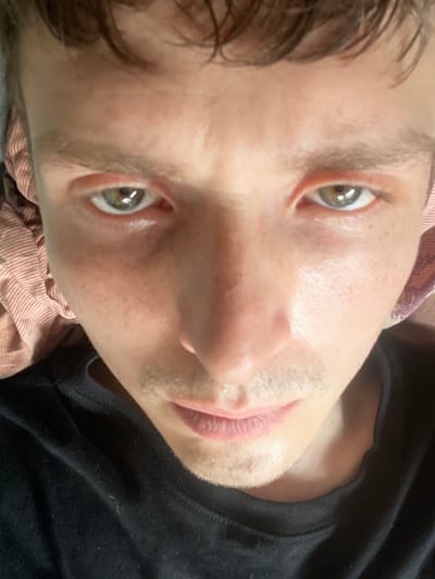 A close-up, low-angle, over-the-shoulder shot features a person's face, predominantly their eyes and mouth. The individual has fair skin with a scattering of freckles. Their eyes are a greenish-brown, with slightly reddened eyelids. The person has light brown eyebrows and short, dark brown hair. A faint upper lip mustache is visible. They are wearing a black t-shirt, and a portion of what appears to be a pink and white striped blanket or piece of fabric is visible to the left of their head. The lighting suggests an indoor setting, possibly a bedroom. The image was taken in Brachterbeek, Netherlands.
