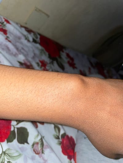 The image displays a human forearm and elbow from an overhead perspective. The skin is a medium-dark brown tone, with fine, sparse, dark hair evident on the forearm. The elbow joint is slightly articulated, revealing its natural contour. The arm rests on or is positioned against a light-colored fabric featuring a repeating pattern of red roses and green leaves. Above the fabric, in the upper background, a blurry, light-toned surface, possibly a wall or headboard, is visible. The lighting is dim, suggesting an indoor environment, with an artificial light source illuminating the arm. No specific geographic location in Nibo, Nigeria, or any other city, can be determined from the visual content.