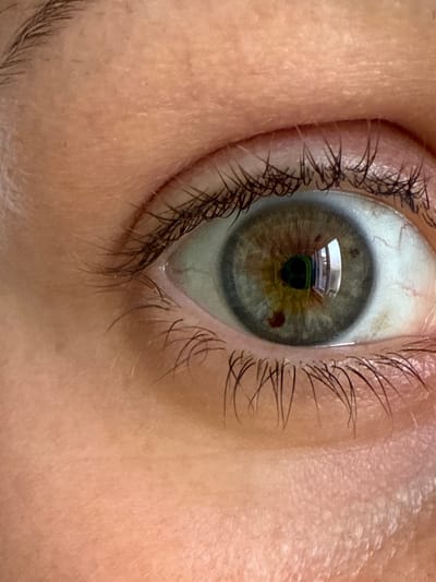 The image is a close-up shot of a human eye. The iris is a mix of green and brown, with a darker brown spot visible on the lower part of the iris. The pupil is black and round. The whites of the eye are visible and appear healthy. Eyelashes frame the eye, and the skin around the eye shows some texture. The lighting in the image highlights the details of the eye and surrounding skin. There is a reflection in the eye, suggesting the presence of windows or a brightly lit environment, but the origin of the reflection is not definitively identifiable. No specific location in Tvarditsa, Bulgaria, can be determined from this image.