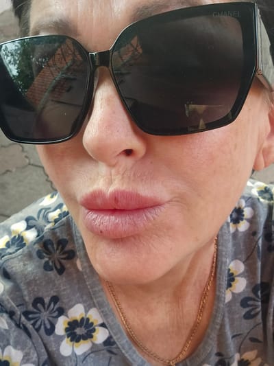 This is a close-up, rotated image of a person wearing sunglasses. The person's face, particularly their mouth and part of their nose, is visible. They appear to be wearing a grey t-shirt with a floral pattern of white, yellow, and dark blue flowers. The sunglasses have dark lenses and thick black frames. The word "CHANEL" is visible in white text on the right lens of the sunglasses. The background appears to be outdoors, with a hint of tiled ground and some greenery reflected in the sunglasses. The lighting suggests it is daytime. The scene captures a personal moment, likely outdoors, given the reflection and general lighting. The person's lips are slightly parted and appear to have some gloss or lipstick on them. The overall impression is casual and relaxed.