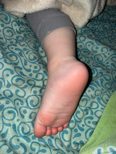 The image shows a close-up of a person's bare foot, resting on a green and teal patterned fabric. The foot is pale pink with visible creases on the sole and toes. A grey knitted sock or band is visible on the ankle, and a beige fuzzy blanket is draped over the leg. The context of Dmitrievka, Russia is not discernible from the image itself.