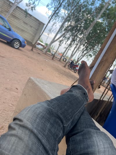 The image depicts a relaxed scene in an outdoor, sandy area, possibly a rest stop or a casual gathering spot in Mayo Dasa, Nigeria. In the foreground, a person's legs, clad in dark denim jeans, are crossed. The person's bare feet are visible, with the left foot resting on top of the right. One foot is dark-skinned. The person appears to be seated on a concrete structure.
In the mid-ground, a blue car is parked on the left, facing away from the viewer. Further back, a red motorcycle is parked, with a rider on it. The environment is characterized by a dirt ground with scattered debris. Tall, thin trees with sparse foliage line the area, creating a natural canopy overhead. A wooden structure with a white stripe runs vertically on the right side of the frame, suggesting it's part of a shelter or seating arrangement. In the background, there are buildings and more trees, indicating a semi-rural or a less developed urban setting. The sky above is partly cloudy. The overall impression is one of a casual, possibly humid, outdoor environment.