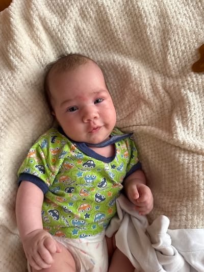 A baby is lying on a cream-colored, fuzzy blanket. The baby is wearing a green short-sleeved onesie with a pattern of cars and stars. The baby has a diaper on and is partially covered by a white cloth. The baby's face is turned slightly to the right, and they appear to be looking at the camera. There are some small red bumps on the baby's forehead. The background is out of focus, but it appears to be the same fuzzy blanket. There is a small, brown object, possibly a toy, to the right of the baby's head. The image is taken from a top-down perspective. The scene is indoors.