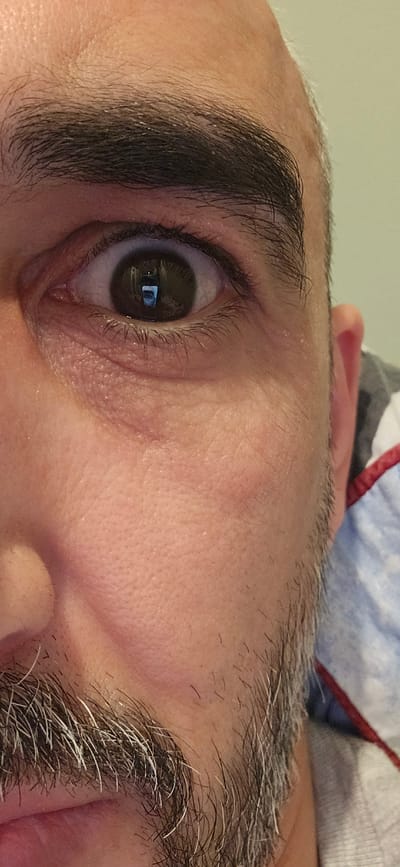 The image is a close-up, slightly rotated portrait focusing on a person's right eye and surrounding facial features. The subject, likely male, has dark brown eyes, with a distinct rectangular reflection visible within the pupil, suggesting an indoor setting with a light source such as a window or screen. Dark, full eyelashes frame the eye, and a thick, dark eyebrow sits above it. The skin around the eye exhibits visible texture, including pores and subtle fine lines. Below the eye, stubble or a short beard is visible, characterized by a mix of dark hairs and numerous prominent grey hairs, indicating age or a natural grey pattern. The overall tone is a detailed, candid portrayal of the upper facial area. No specific activity is depicted other than the subject gazing directly at the camera. The image provides no specific visual cues to its location, but the context indicates Norwich, United Kingdom. There is no visible text.