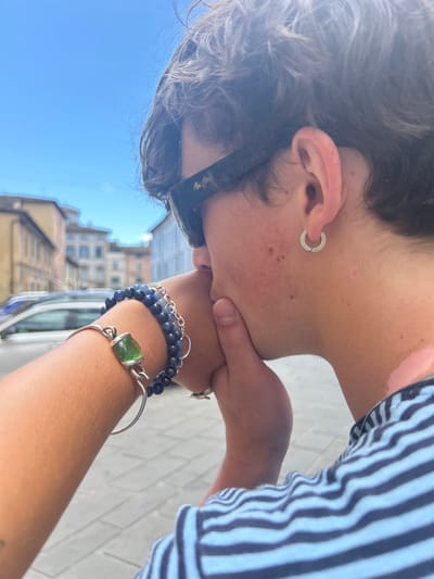 This close-up, outdoor image, captured in Foligno, Italy, depicts two individuals under a clear blue sky. A person on the right, shown in profile, has short, dark, wavy hair, wears dark Maui Jim sunglasses, and a silver hoop earring in the right ear. Patches of skin depigmentation are visible on their lower right neck and shoulder. This individual, dressed in a blue and white striped shirt, has their face positioned against the left forearm of a second individual, appearing to kiss or nuzzle it. The second person's left forearm, visible on the left, is adorned with a silver bangle featuring a large, rectangular green stone, multiple strands of dark blue beaded bracelets, and a silver chain bracelet. A small silver ring is visible on the ring finger of the hand. The background reveals light-colored, multi-story buildings typical of Italian architecture, lining a street with blurred vehicles and a paved ground surface.