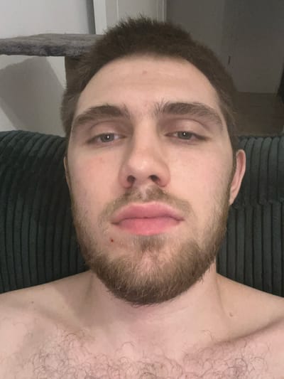 The image is a close-up, head-on portrait of a young man with light brown hair, fair skin, and a beard. He has brown eyes and prominent eyebrows. His lips are slightly parted, revealing a small red mark on his upper lip. He is shirtless, and his chest hair is visible. The background is out of focus, showing a dark, textured surface that appears to be a piece of furniture, possibly a couch. To the left of his head, a gray, carpeted surface is visible, suggesting some sort of elevated structure. The lighting is dim, casting soft shadows on his face. The image does not contain any information that would allow for the determination of its location in Pruszcz Gdański, Poland.
