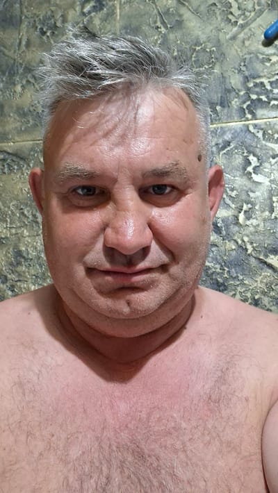 The image is a close-up, head-and-shoulders selfie of a middle-aged man with graying hair. He is looking directly at the camera with a neutral expression. His skin appears flushed, and he has noticeable wrinkles on his forehead. There is a small mole on his left cheek and another on his chin. The background is a textured wall, possibly in a bathroom, with a bluish-gray and green mottled pattern. A small piece of blue plastic is visible in the upper right corner. The man is shirtless, and his chest hair is visible. The lighting is somewhat harsh, creating shadows and highlighting the texture of his skin. There are no other people or objects of significance in the frame. The image does not provide any information about the location in the city of Voinova, Moldova.