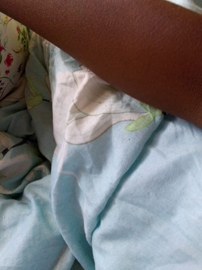 A forensic description of an indoor scene in Kalimoni ward, Kenya. The image captures a close-up view of a dark brown human forearm, positioned diagonally from the upper right to the lower left. The arm exhibits visible skin texture, including small follicular elevations. It rests upon a light blue patterned fabric, likely bedding, which features white and light green stylized botanical motifs. Small fibers and pilling are discernible on this fabric. A second, multi-colored floral patterned fabric, displaying red and green elements on a white background, is partially visible in the upper left quadrant. No other individuals or active interactions are observed. The environment is consistent with a private indoor space, likely a bedroom, given the presence of bedding.