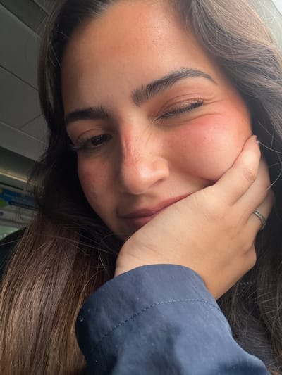 A close-up, slightly angled portrait shows a woman with brown hair and light skin. Her right hand is partially obscuring her face, with fingers pressing into her cheek. She has dark eyebrows and one eye appears closed or squinting. Her cheek has a reddish hue. She is wearing a ring on her finger. Part of a navy blue fabric, possibly clothing, is visible on the right side of the image. The background is blurred and indistinct. There is no information in the image to suggest the location of the city of San Antonio, United States of America.