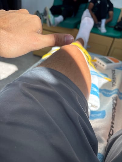 A person's leg with yellow wires attached is visible, resting on a blue and white towel. A white medical device sits nearby. In the background, another person is seen with a white sock and a light green shoe. The primary subject gives a thumbs-up, with their hand visible. The person's gray shorts are wrinkled and in focus. The scene suggests a medical or therapeutic setting.