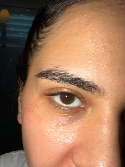 An eye, brow, forehead, and nose are featured in a close-up shot. The eye is brown, and the eyebrow is dark and well-defined. The skin on the forehead and around the eye appears smooth and slightly shiny. Some very faint hairs are visible at the hairline. Part of a nose is also visible on the right side of the frame.