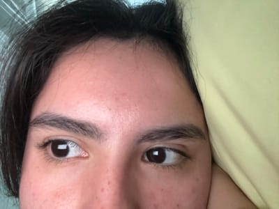 A close-up, tilted image shows the upper portion of a person's face. The person has brown eyes that are glancing to the side, dark eyebrows, and fair skin with some freckles. Dark hair is visible along the forehead and on the right side of the frame. The person is lying down on a yellow-green pillow or surface. The environment is undiscernible. The image's location cannot be determined from the image alone.