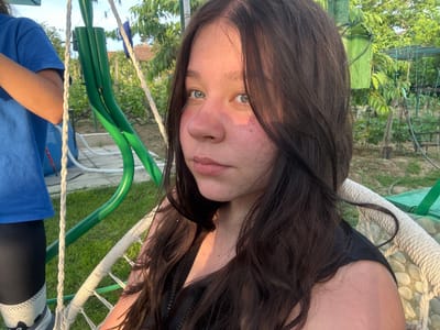 This image captures a young female in an outdoor garden setting within the city of Byala, Bulgaria. The primary subject, a female with long dark brown hair and light blue eyes, is seated on a white woven rope swing, looking directly at the viewer. Her face, particularly her nose and cheeks, and her exposed right shoulder exhibit sun-induced reddish tones, indicating direct sun exposure from the left side of the frame. She is wearing a dark, possibly black, top with a zipper detail on the chest. To her left, a second individual is partially visible, wearing a blue t-shirt, black leggings, and a grey and white sock featuring a black cat design on the left foot. A green metal swing frame is present, along with white braided ropes supporting the swing. The background consists of a garden area with green grass, bare earth, numerous trees, and foliage. In the distant background, a building with a terracotta-tiled roof is visible, along with clothes hanging on a clothesline. A garden shovel, a white hose, and a blue container are also discernible elements within the scene. The lighting suggests natural sunlight during the early morning or late afternoon.