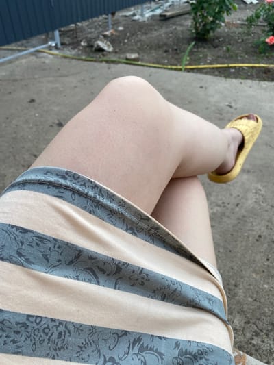 The image shows a close-up of a person's legs, crossed at the knees, and a portion of their striped skirt. One leg is wearing a yellow slide sandal. The background appears to be an outdoor setting with a concrete surface, a dark blue fence, and some plants. Based on the provided hints and context, this scene is located in Kisliakovskaya, Russia.