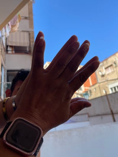 The image shows a close-up of a person's hands against a bright blue sky, with a blurred background of buildings. The person is wearing a smartwatch with a decorative bezel and two bracelets, one silver and one gold. The hands are positioned as if in prayer or to shield from the sun. The sunlight is strong, suggesting it is daytime. The background shows architectural details of buildings, possibly in a Mediterranean style, with balconies and windows. A glimpse of another person's head and shoulders is visible in the lower part of the frame, also in silhouette. The scene appears to be outdoors, likely in a location with clear, sunny weather. There is no visible text in the image.