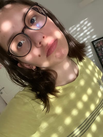 A medium shot selfie shows a young woman with shoulder-length dark brown hair and glasses. She is wearing a yellow t-shirt with dark stripes. The light in the image is dappled, creating a pattern of circles on her face, hair, and shirt, suggesting she is near a window with blinds or a similar light-filtering object. The background is a light-colored wall with a framed picture visible on the right. A doorknob is visible on the left. No specific location in Marten, Bulgaria is identifiable from the image.