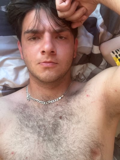This is a close-up, self-taken photograph of a shirtless young man lying down. He has dark hair and brown eyes. He is wearing a silver chain necklace. His chest is covered in dark hair. There are some red spots on his skin, particularly on his right armpit area and chest. The background appears to be a patterned duvet or bedsheets. The photograph does not contain any information about its location in Tomaszów Mazowiecki, Poland.