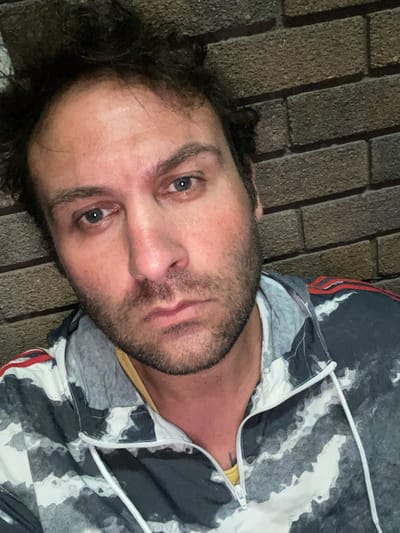 The image is a close-up, selfie-style photograph of a man with dark, unkempt hair and a beard. He has pale skin with some redness and what appears to be makeup or discoloration around his eyes and cheeks. His eyes are open and looking directly at the camera with a somber expression. He is wearing a jacket with a black, white, and gray abstract pattern and a yellow garment underneath. The background consists of a textured brick wall. The image does not contain any discernible information that would allow for the determination of its location within the city of Armagh, United Kingdom.